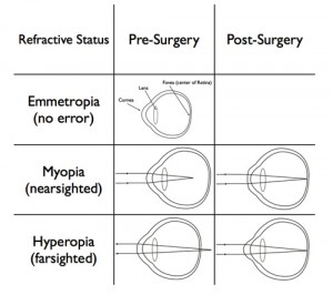 Figure One - Emmetropia Figure One - Emmetropi